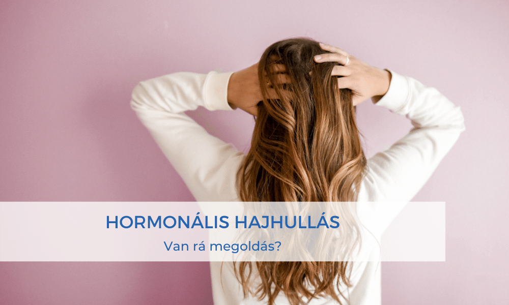 hormonális hajhullás
