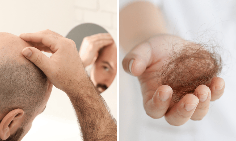 férfi hajápolás