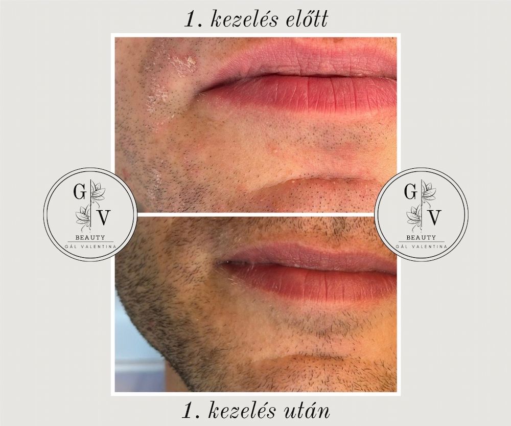 GV Beauty Glow Kozmetika - Szombathely kozmetika 9 gal valentina beauty collection szombathely kozmetika UJ 011