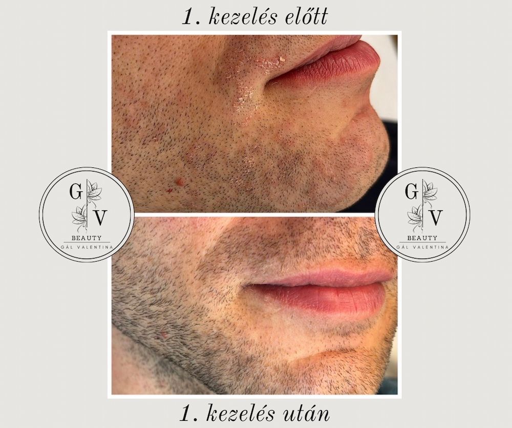 GV Beauty Glow Kozmetika - Szombathely kozmetika 8 gal valentina beauty collection szombathely kozmetika UJ 012