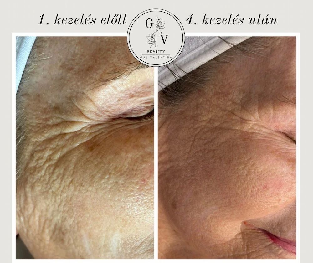 GV Beauty Glow Kozmetika - Szombathely kozmetika 7 gal valentina beauty collection szombathely kozmetika UJ 013