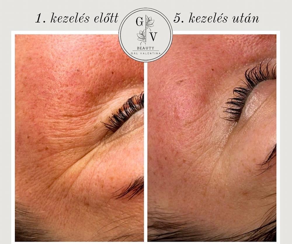 GV Beauty Glow Kozmetika - Szombathely kozmetika 6 gal valentina beauty collection szombathely kozmetika UJ 014