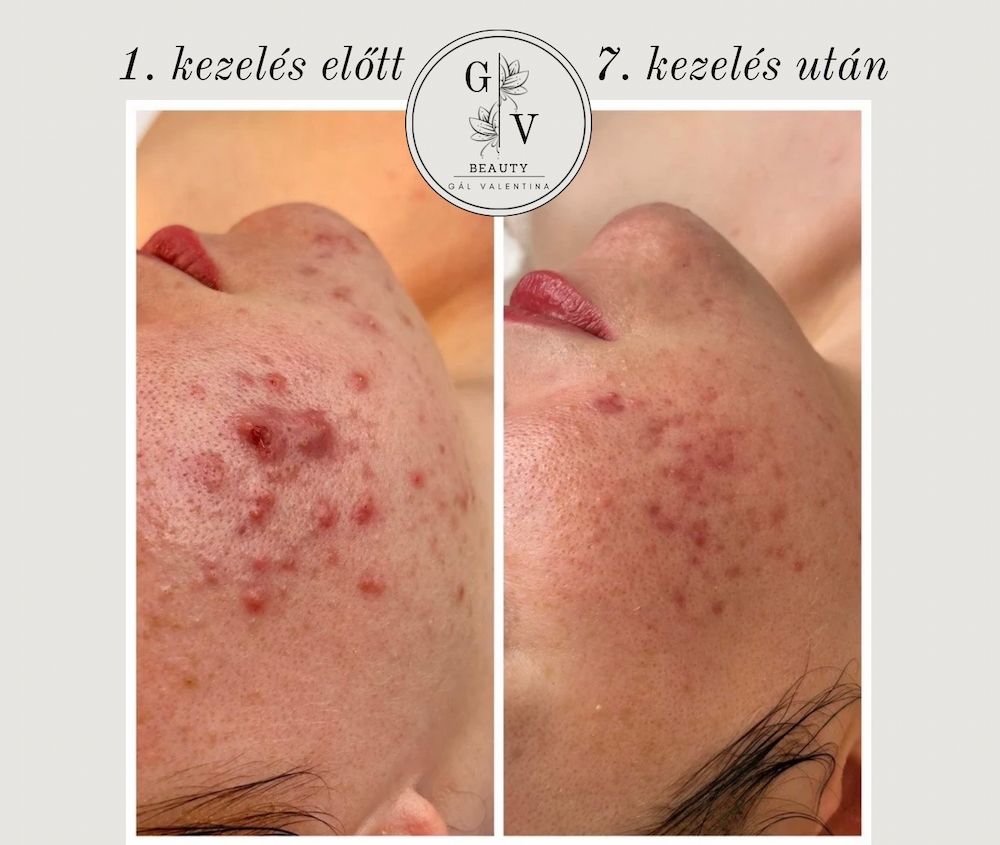 GV Beauty Glow Kozmetika - Szombathely kozmetika 5 gal valentina beauty collection szombathely kozmetika UJ 015