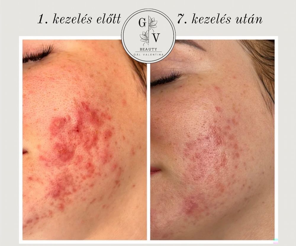 GV Beauty Glow Kozmetika - Szombathely kozmetika 4 gal valentina beauty collection szombathely kozmetika UJ 016