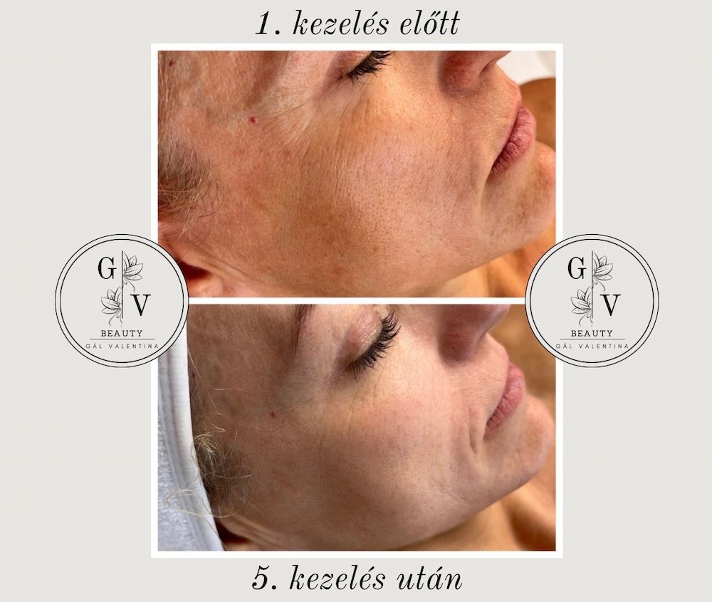 GV Beauty Glow Kozmetika - Szombathely kozmetika 3 gal valentina beauty collection szombathely kozmetika UJ 017