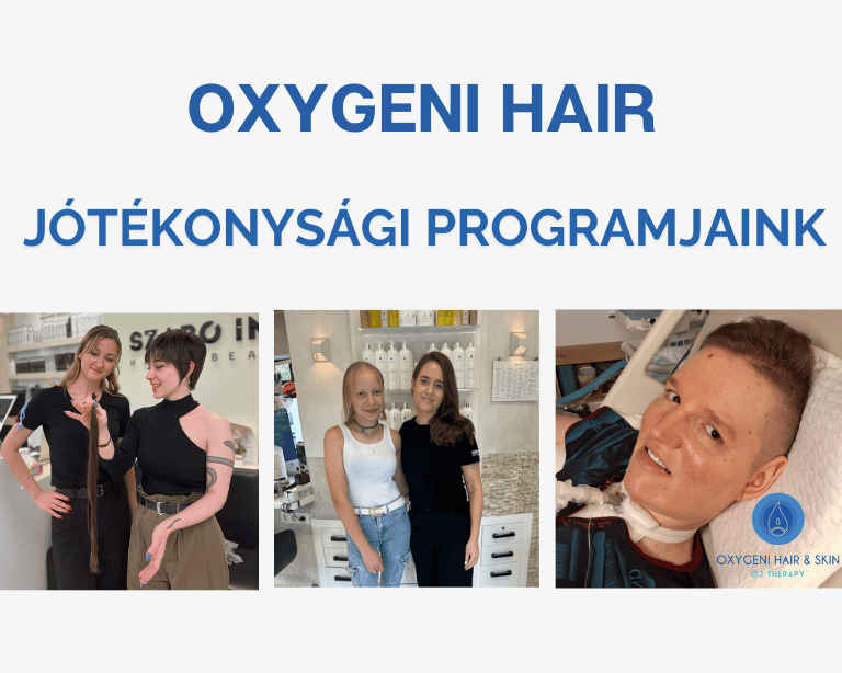 uj oxygeni web mobil banner 1