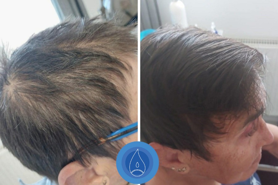 Eredmenyek Kerekes Judit 15 alkalom