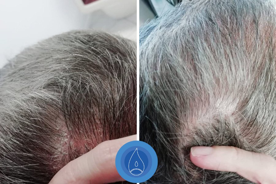 Eredmenyek Kerekes Judit 5 alkalom