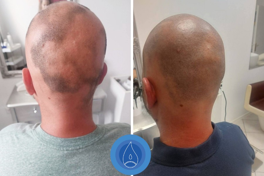 Eredmenyek Kerekes Judit 7 alkalom foltos hajhullas