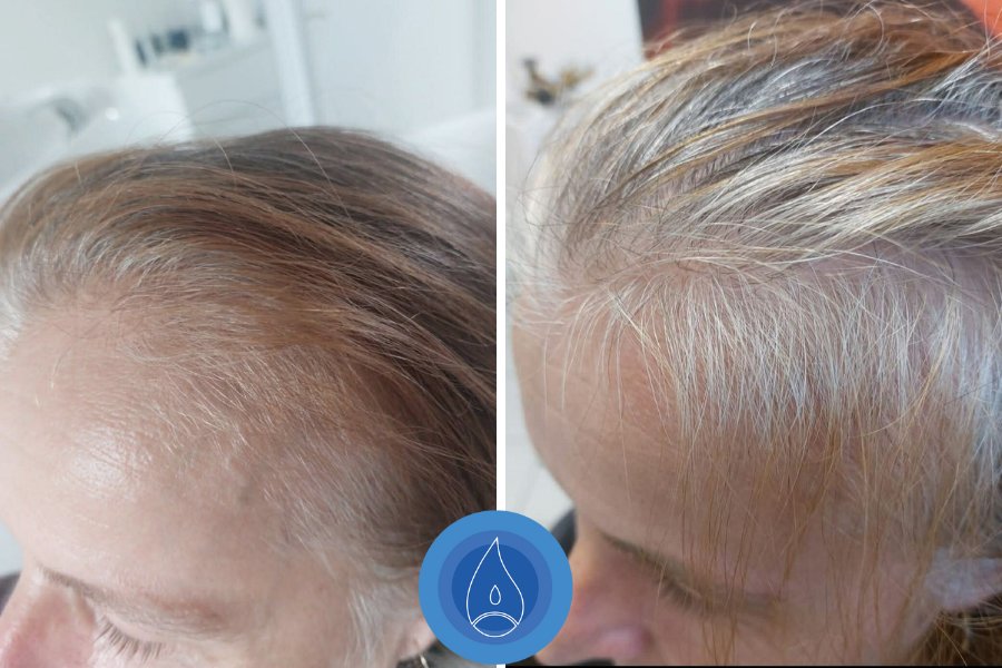 Eredmenyek Kerekes Judit Tata 8 alkalom