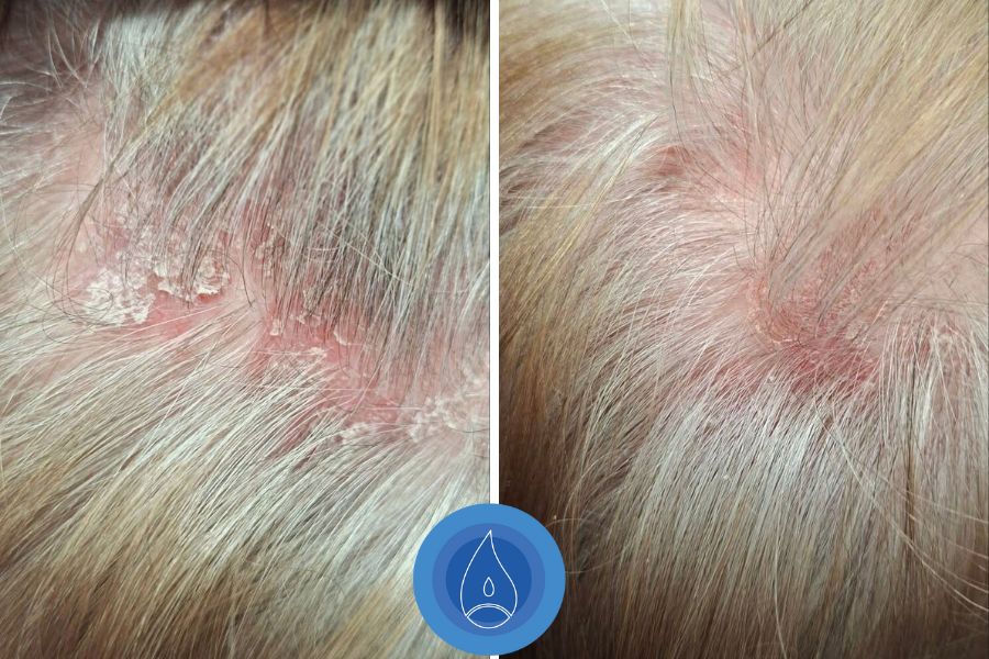 Eredmenyek Toth Csilla 1 alkalom