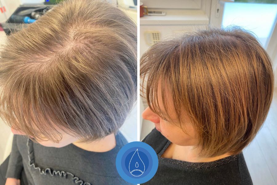 Eredmenyek Kardos Szucs Bettina 5 alkalom