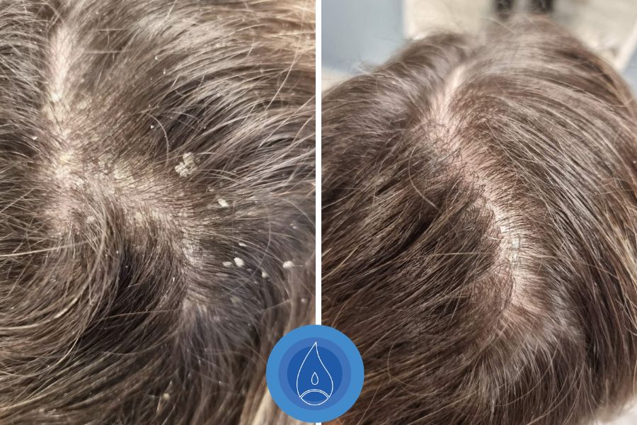 Eredmenyek Koleszar Andrea 1 alkalom