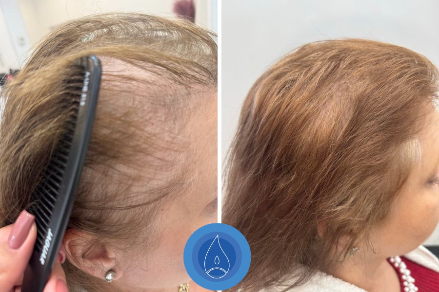 Eredmenyek Monika Suranyi 10 alkalom