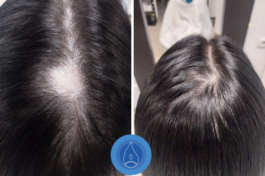 Eredmenyek Pach Rita 10 alkalom