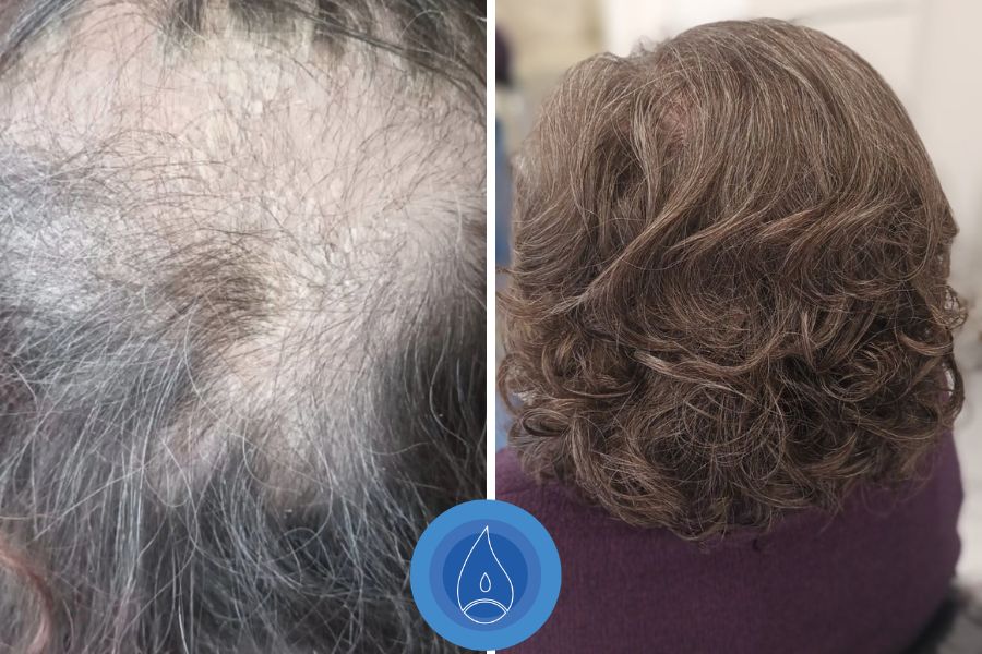 Eredmenyek Toth Csilla 10 alkalom