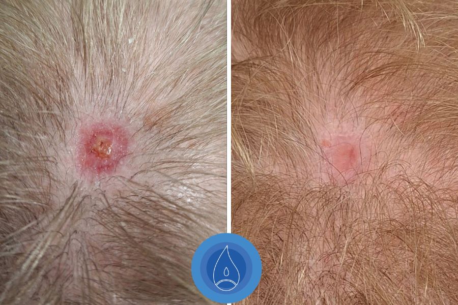 Eredmenyek Toth Csilla 4 alkalom talyogos seb