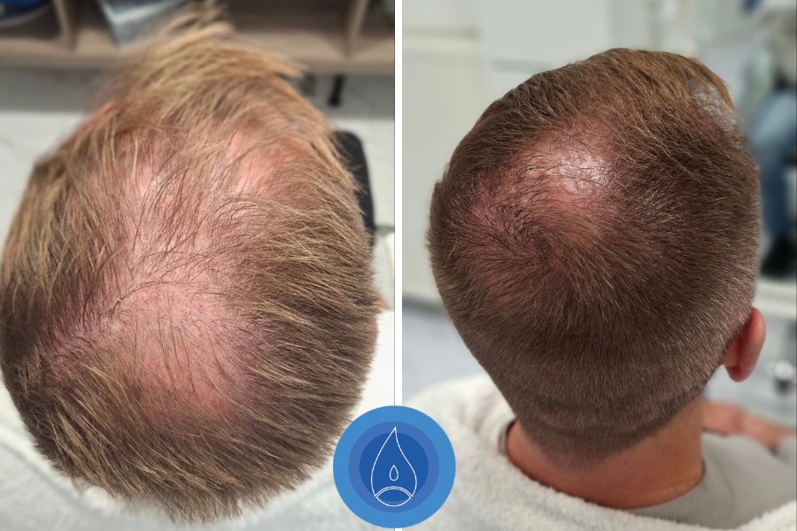 Eredmenyek Toth Csilla 5 alkalom