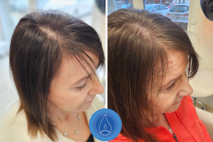 Eredmenyek Andras Edina 5 alkalom 2