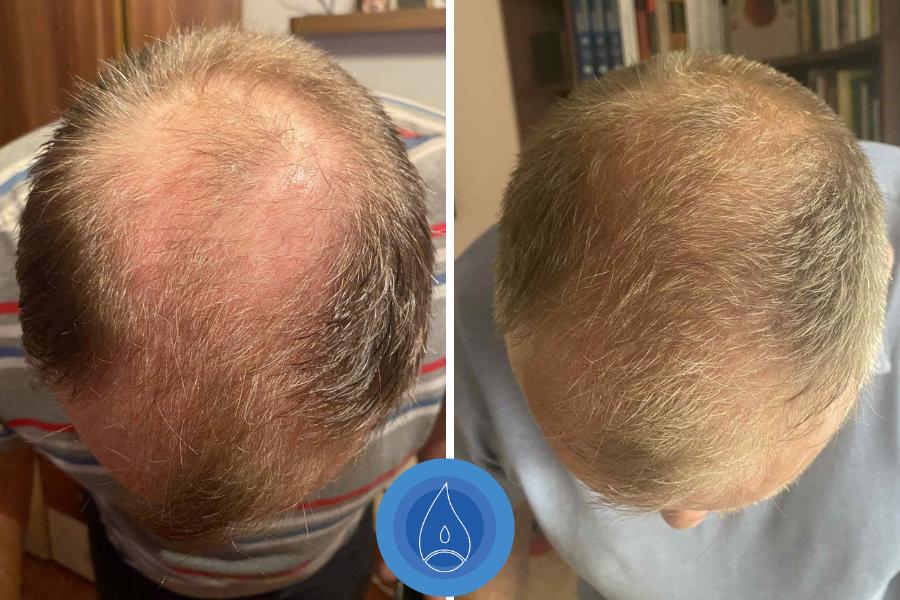 Eredmenyek Andras Edina 5 alkalom