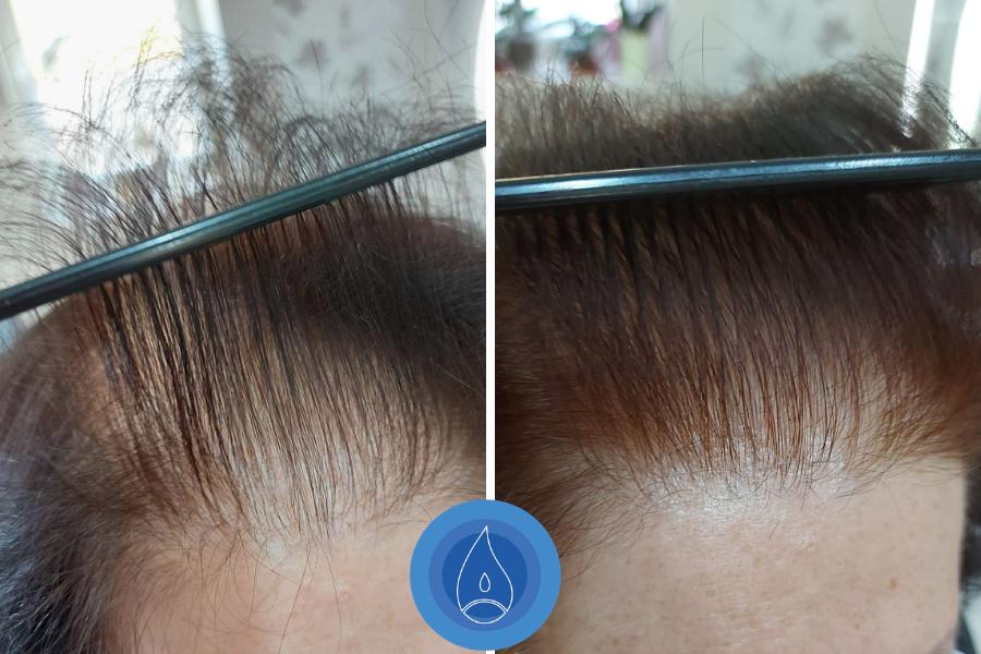 Eredmenyek Czesznak Timea 4 alkalom