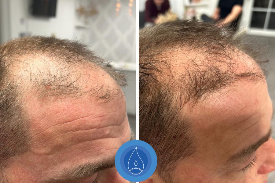 Eredmenyek Fazekas Monika 5 alkalom