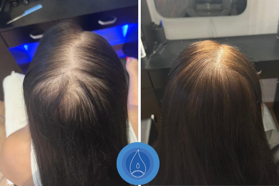 Eredmenyek Lengyel Dora 5 alkalom