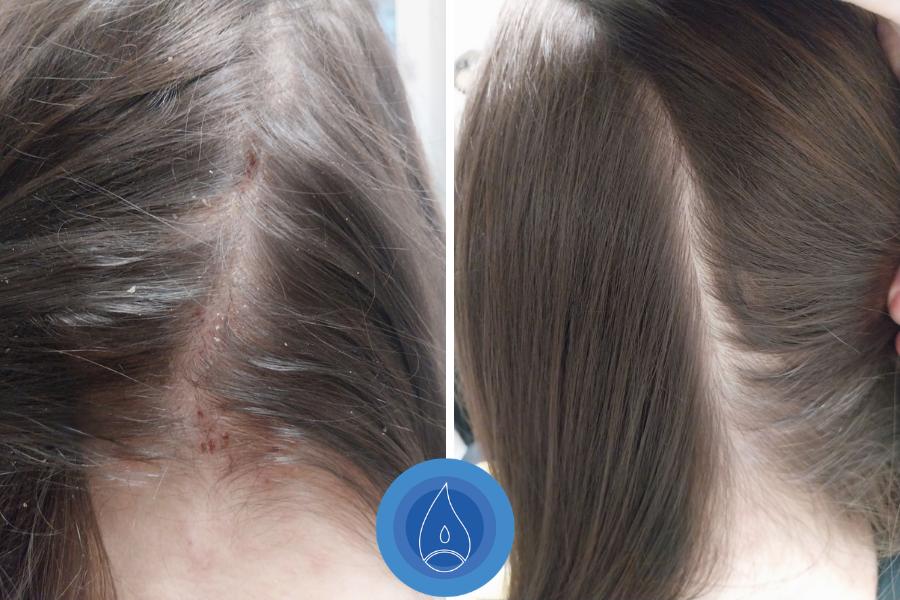 Eredmenyek Pach Rita 5 alkalom 2