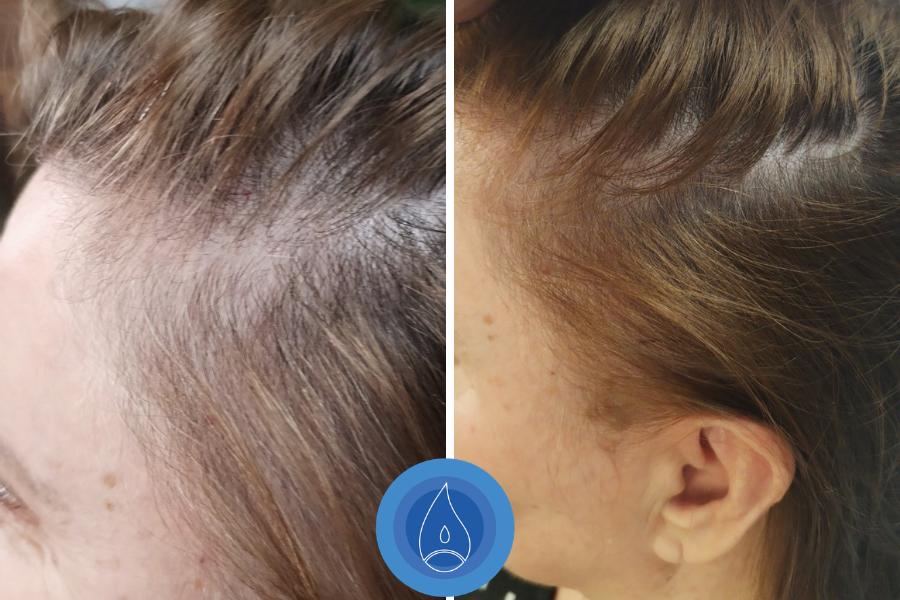 Eredmenyek Pap Edit 5 alkalom