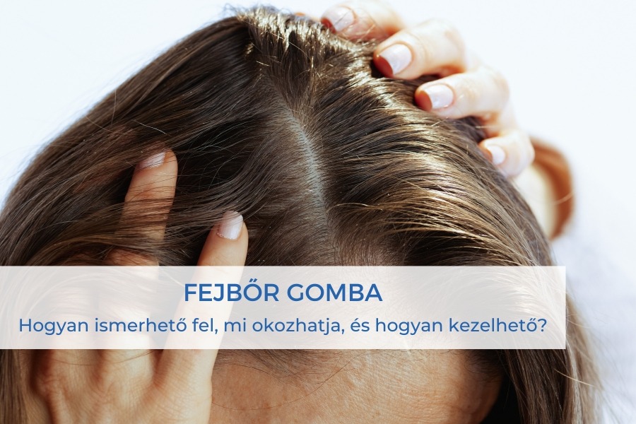 Természetes hajápolás gabonafélékkel - 10 superfood tipp 24 fejbőr-gomba
